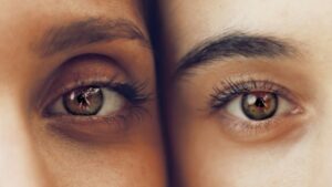 Ocular Psychology: Mirroring the Mind Through the Retina
