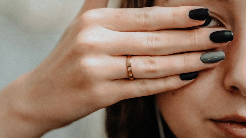 Psychosomatic Dermatitis: When Your Ring Becomes Stressful