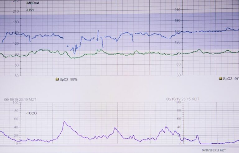 Response Amplitude: Measuring the Power of Human Behavior