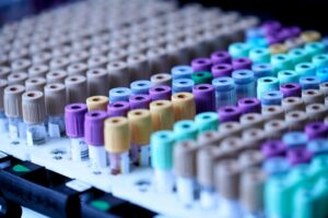 SADS Assessment: Mastering Clinical Diagnostic Precision