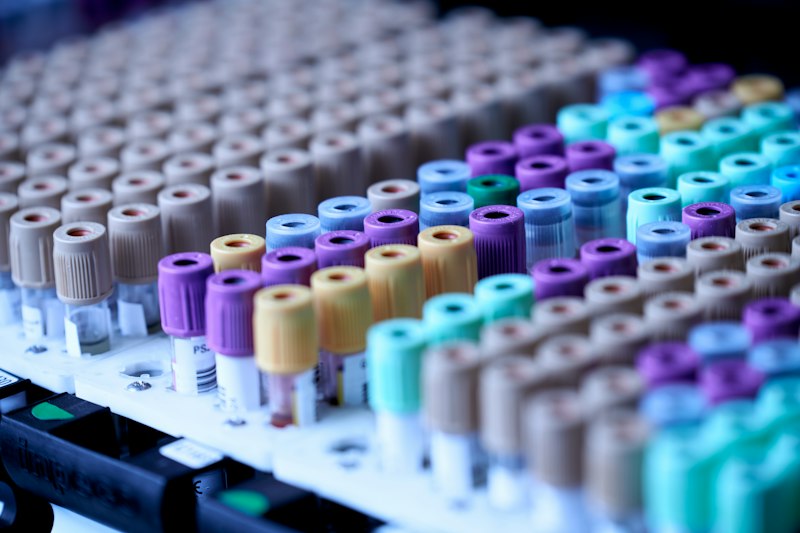 SADS Assessment: Mastering Clinical Diagnostic Precision