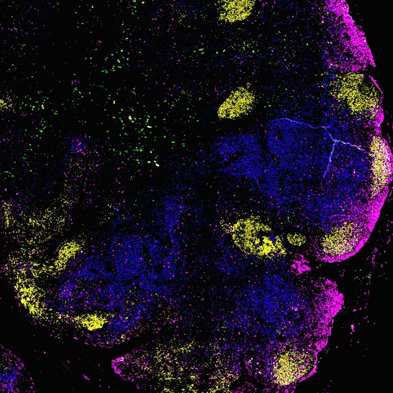 Schizophrenia: Decoding the New Diagnostic Era