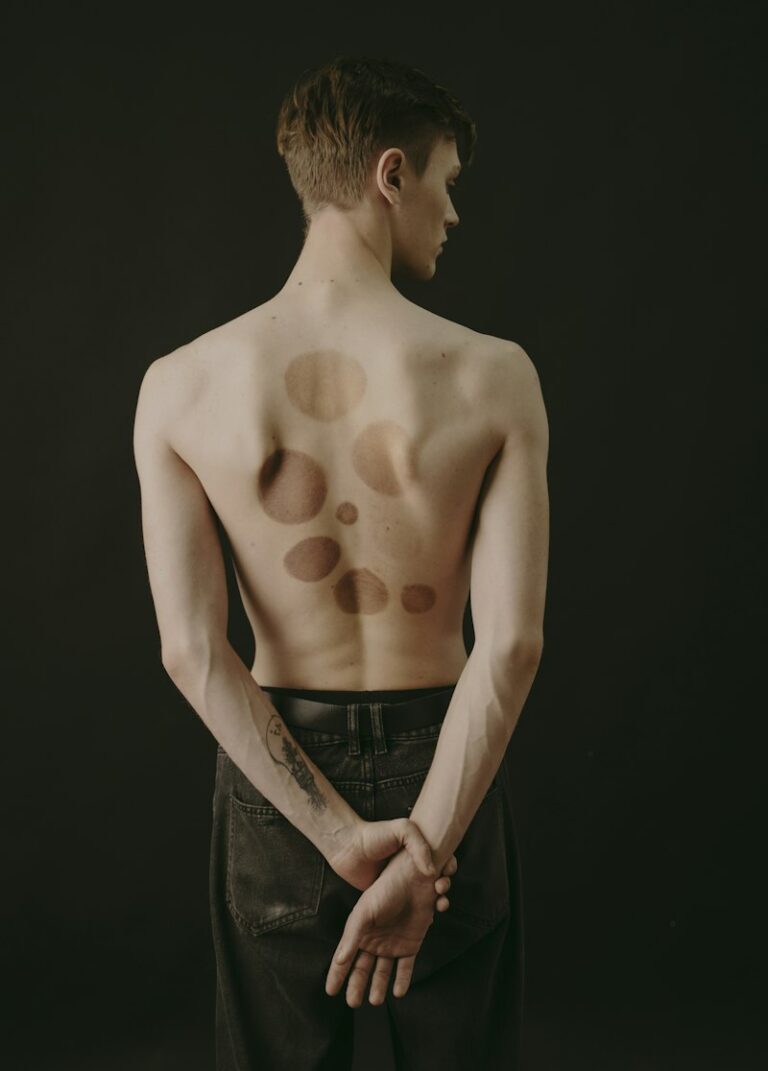 Self-Harm: Understanding the Psychology of Body Modification