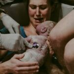 Cesarean Birth: Navigating the Complex Emotional Landscape