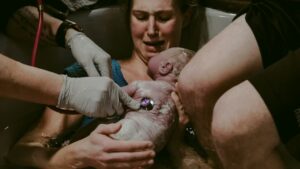 Cesarean Birth: Navigating the Complex Emotional Landscape