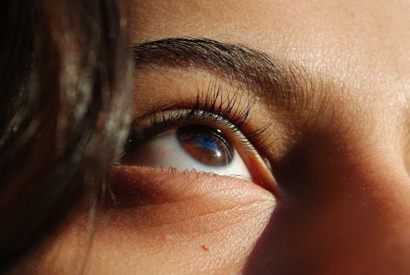 Strabismus: How Eye Alignment Shapes Your Self-Image