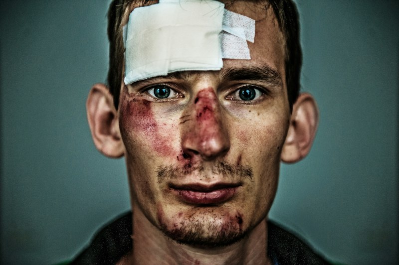 Traumatic Brain Injury: Unmasking the Invisible Wound